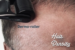 Comparaison Des Dermarollers  Domicile Et Du Microneedling Clinique Pour La Croissance Des Cheveux