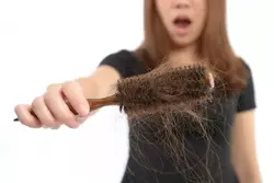 Les strodes peuventils causer la perte de cheveux